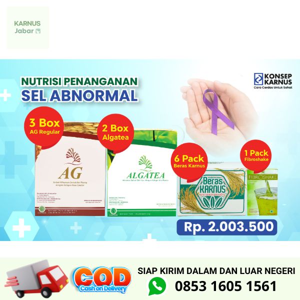 Nutrisi Penanganan Sel Abnormal - Tumor Kanker Autoimun Lupus