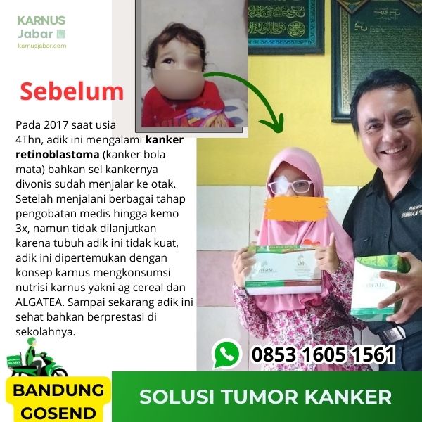 Nutrisi Penanganan Sel Abnormal - Tumor Kanker Autoimun Lupus - Image 3